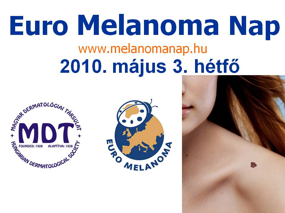 melanoma_nap_2010